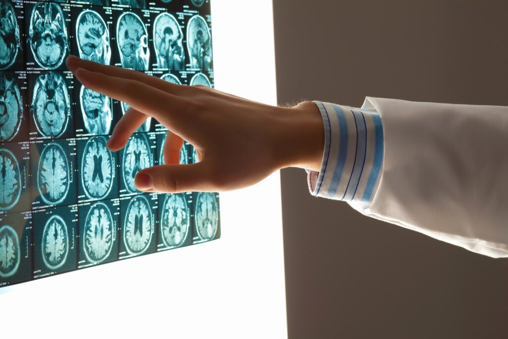 traumatic brain injury lawyer in Scottsdale AZ